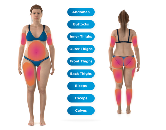 EMsculpt Body Areas