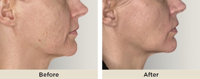 B&A_thumbnail_julaine2.jpg