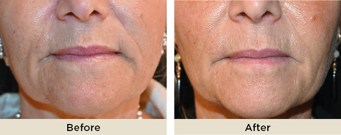 B&A_thumbnail_julaine34.jpg
