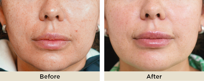 B&A_thumbnail_julaine33.jpg