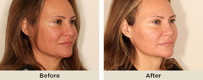 B&A_thumbnail_julaine_threads3.jpg
