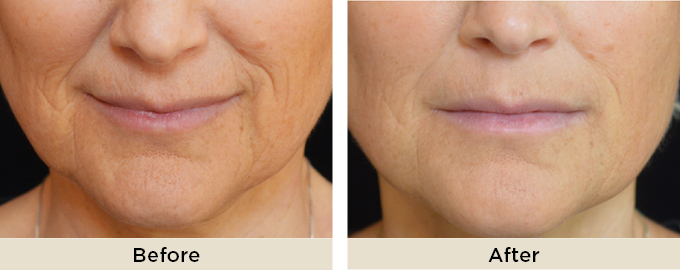 B&A_thumbnail_julaine3.jpg