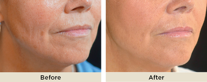 B&A_thumbnail_julaine32.jpg