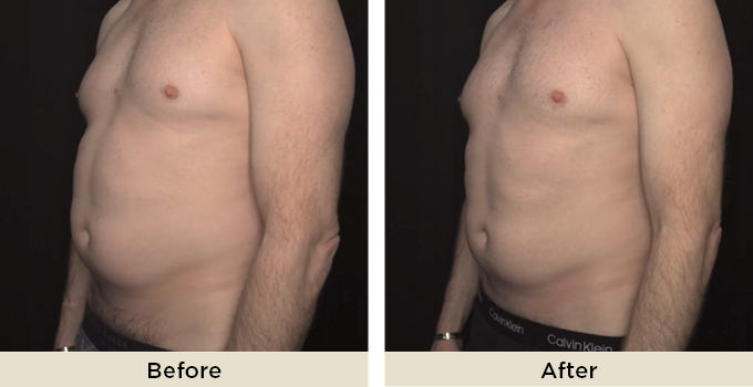 B&A_thumbnail_pureimpact.jpg