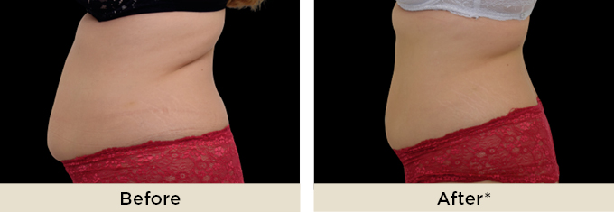 B&A_neo_main4.jpg