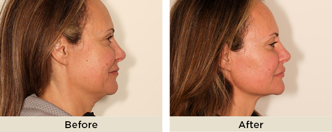 B&A_thumbnail_julaine_threads.jpg