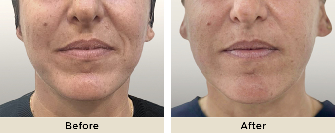 B&A_thumbnail_julaine.jpg