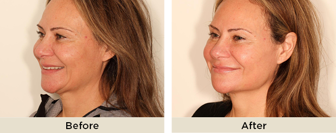 B&A_thumbnail_julaine_threads2.jpg