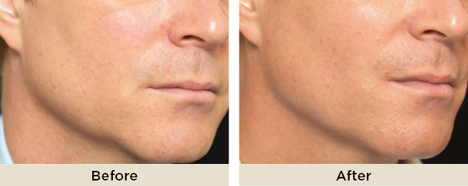 B&A_thumbnail_julaine35.jpg