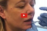 Dr Rita Rakus Lip Top Up Video
